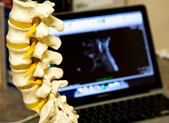 model of spinal column with computer screen in the background